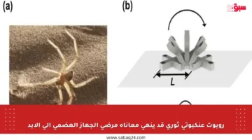 روبوت عنكبوتي ثوري قد ينهي معاناة مرضى الجهاز الهضمي إلى الأبد